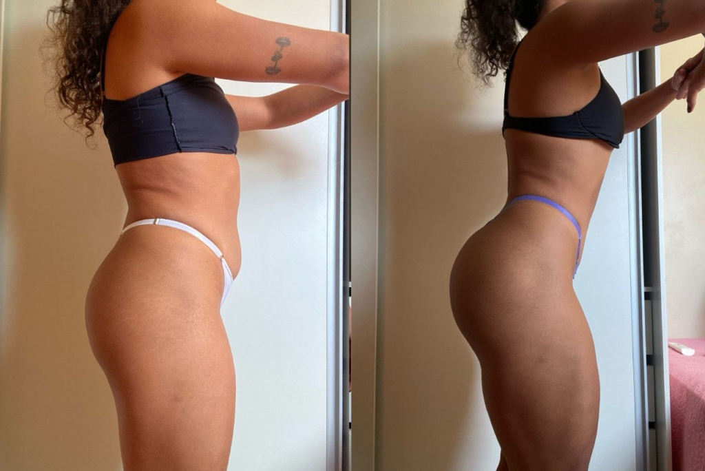 antes e depois igor kenol personal trainer brasilia